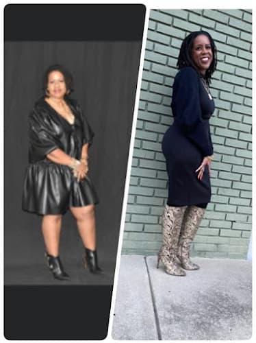 Elite Diet and Aesthetics