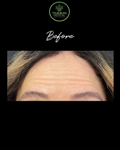 True Bliss Medical Aesthetics and Wellness