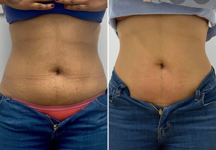 Dr. G's Weight Loss King of Prussia